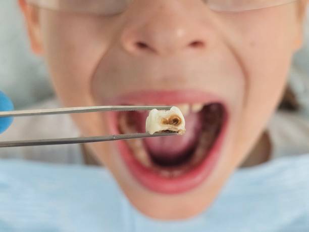 Best Tooth Pain Emergency Relief  in Yardville, NJ