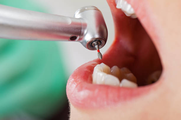 Best Cracked Tooth Emergency Dentist  in Yardville, NJ